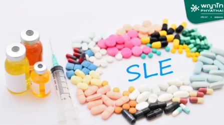 SLE