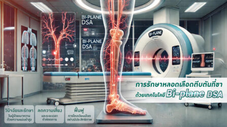 Bi-Plane DSA : เทคโนโลยีเอกซเรย์ ช่วยในการวินิจฉัยและรักษาโรคหลอดเลือดอุดตันส่วนแขนและขา โดยไม่ต้องผ่าตัด