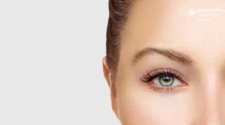 Double Eyelid Surgery