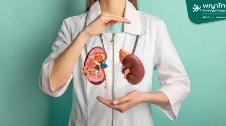 Arteriovenous Fistula (AV Fistula) for Chronic Kidney Disease Patients