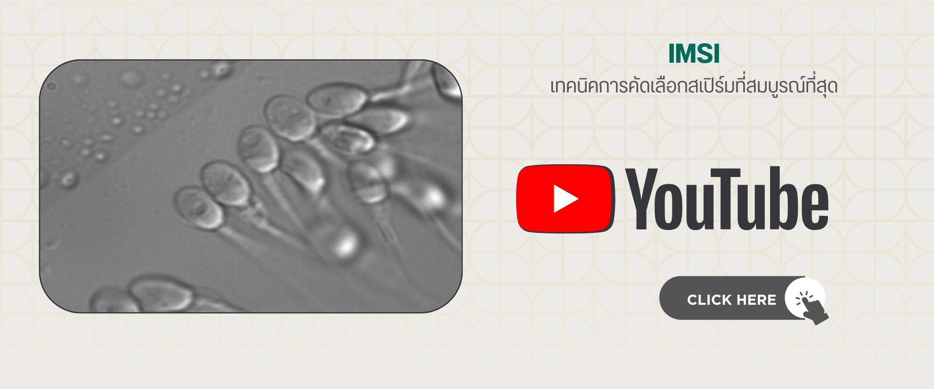 IMSI เทคนิคการคัดเลือกสเปิร์มที่สมบูรณ์ที่สุด